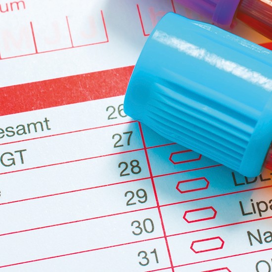 Bluttest-Röhrchen; Foto: Alexander Raths - Fotolia.com